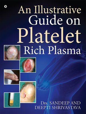 cover image of An Illustrative Guide on Platelet Rich Plasma